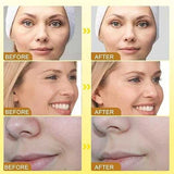 Bee Venom Wrinkle Removal Cream – Anti-Aging Face & Neck Firming Moisturizer for Youthful Skin