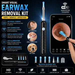 Wireless Ear Wax Removal Tool with HD Camera & LED Light
